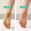 Patchology POSHPEEL XL Pedi Cure