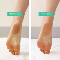 Patchology POSHPEEL XL Pedi Cure