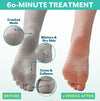 Patchology POSHPEEL XL Pedi Cure